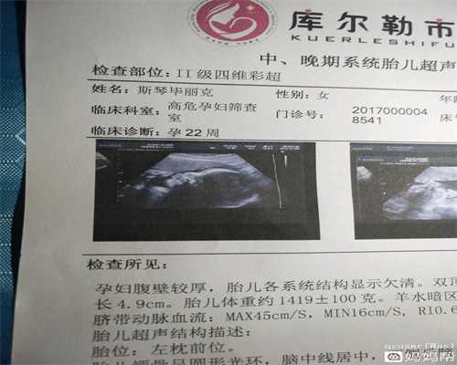 人工代孕怎么回事_生殖中心代孕过程_天津哪家医院能做试管婴儿？什么季节做